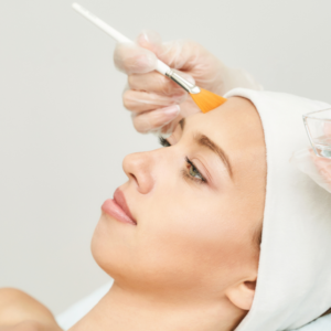 CHEMICAL PEEL